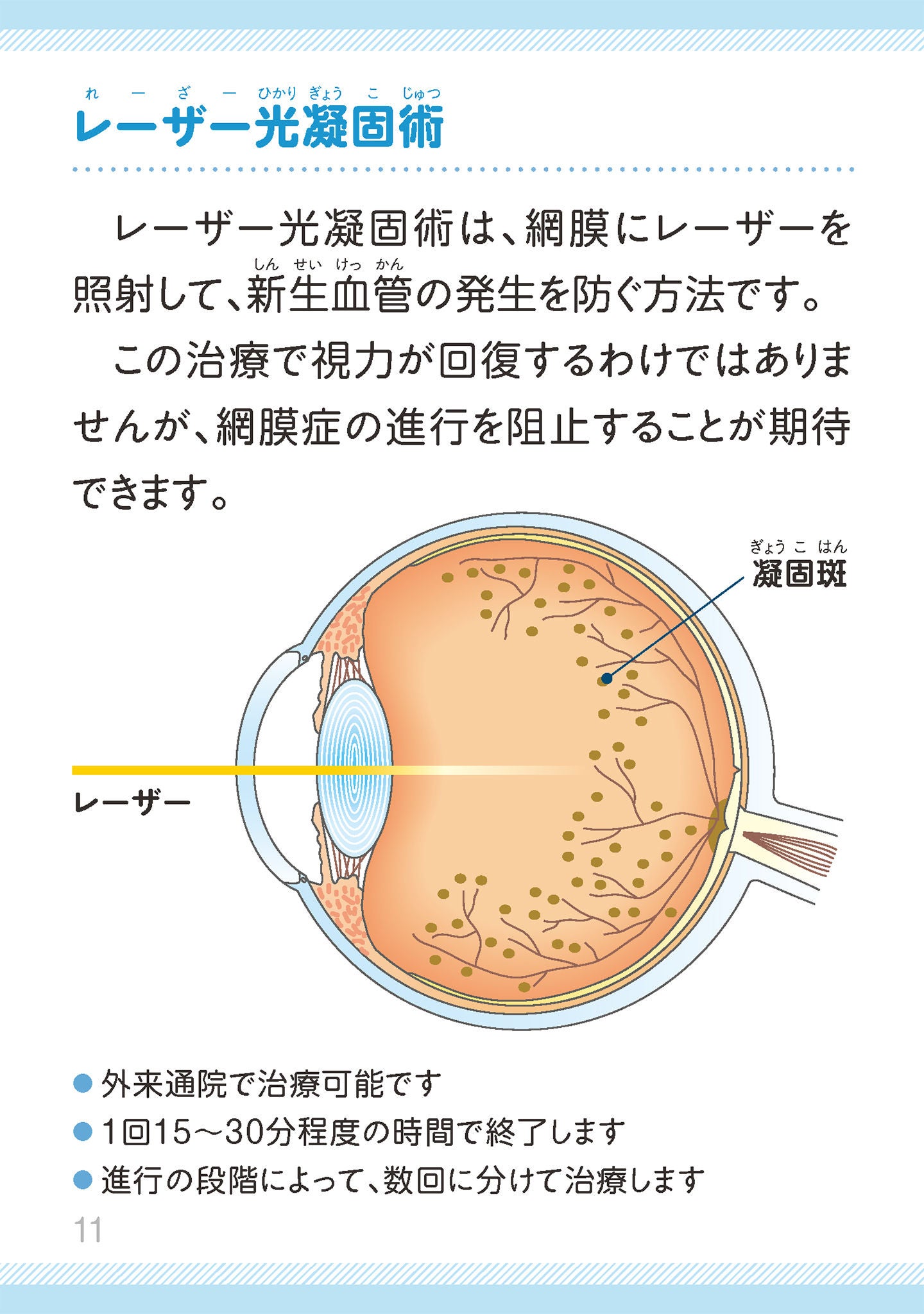 糖尿病網膜症の治療には、どのようなものがあるますか？