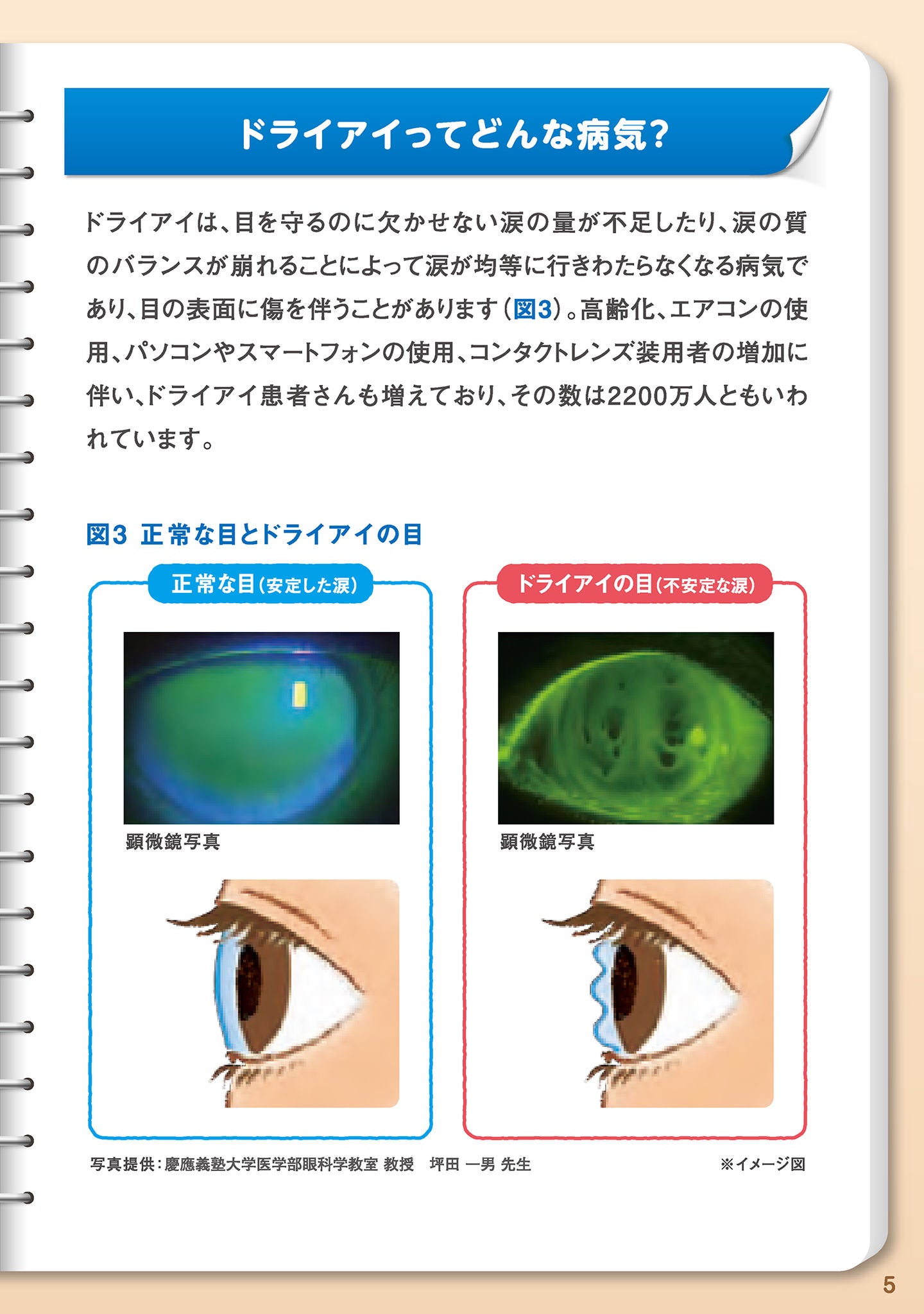 涙は目を守るための大切なもの