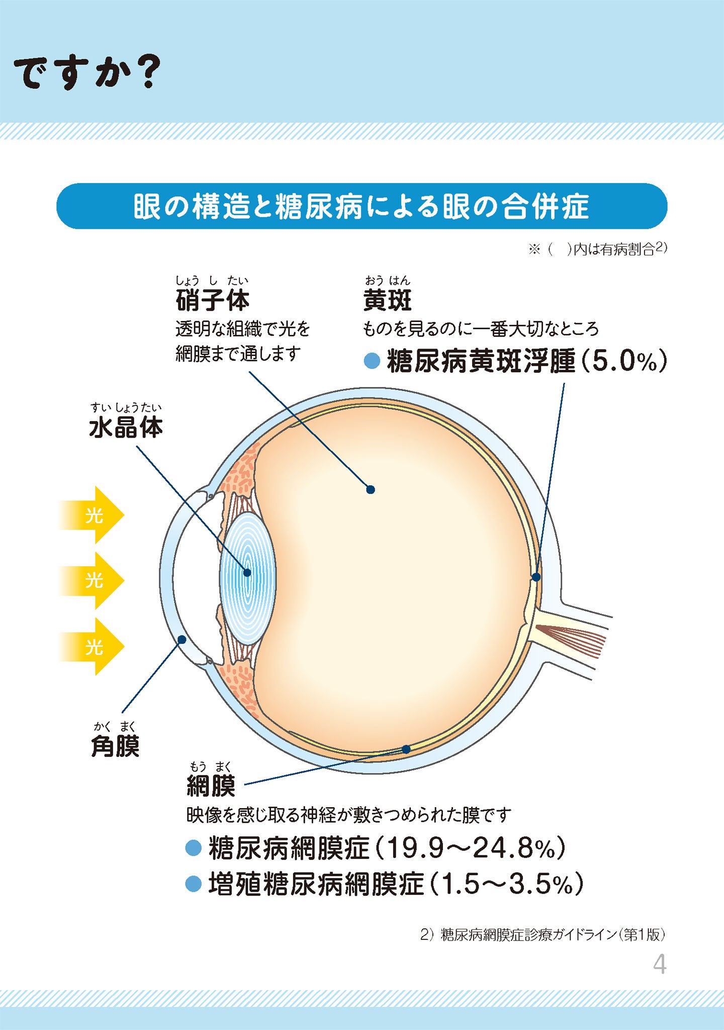 どうして、糖尿病で目が悪くなるのですか？