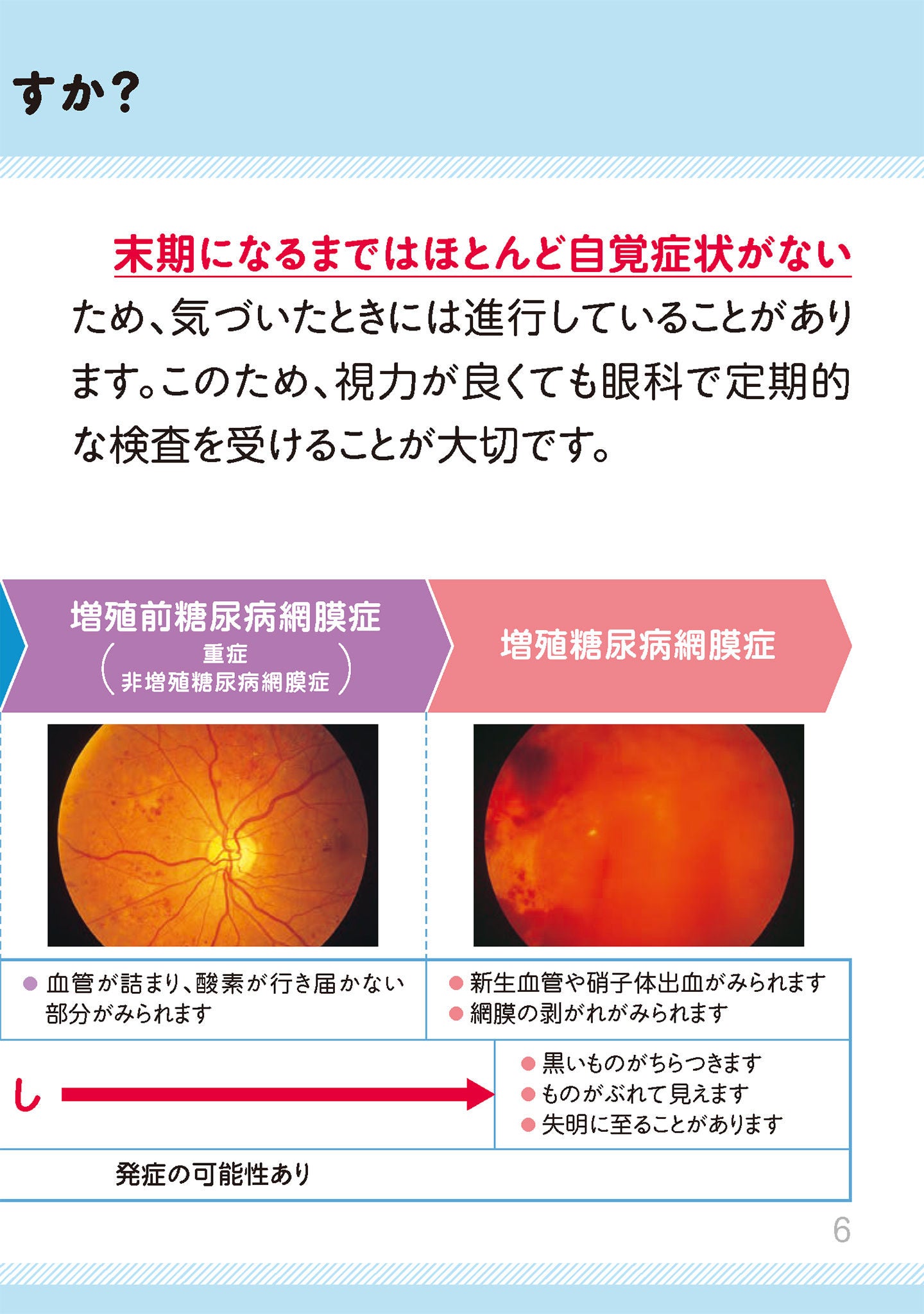 糖尿病網膜症になると失明するのですか？