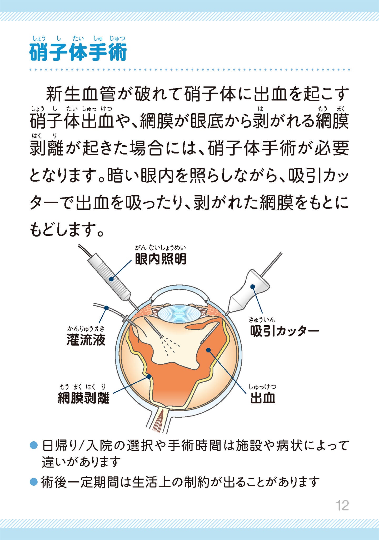 糖尿病網膜症の治療には、どのようなものがあるますか？