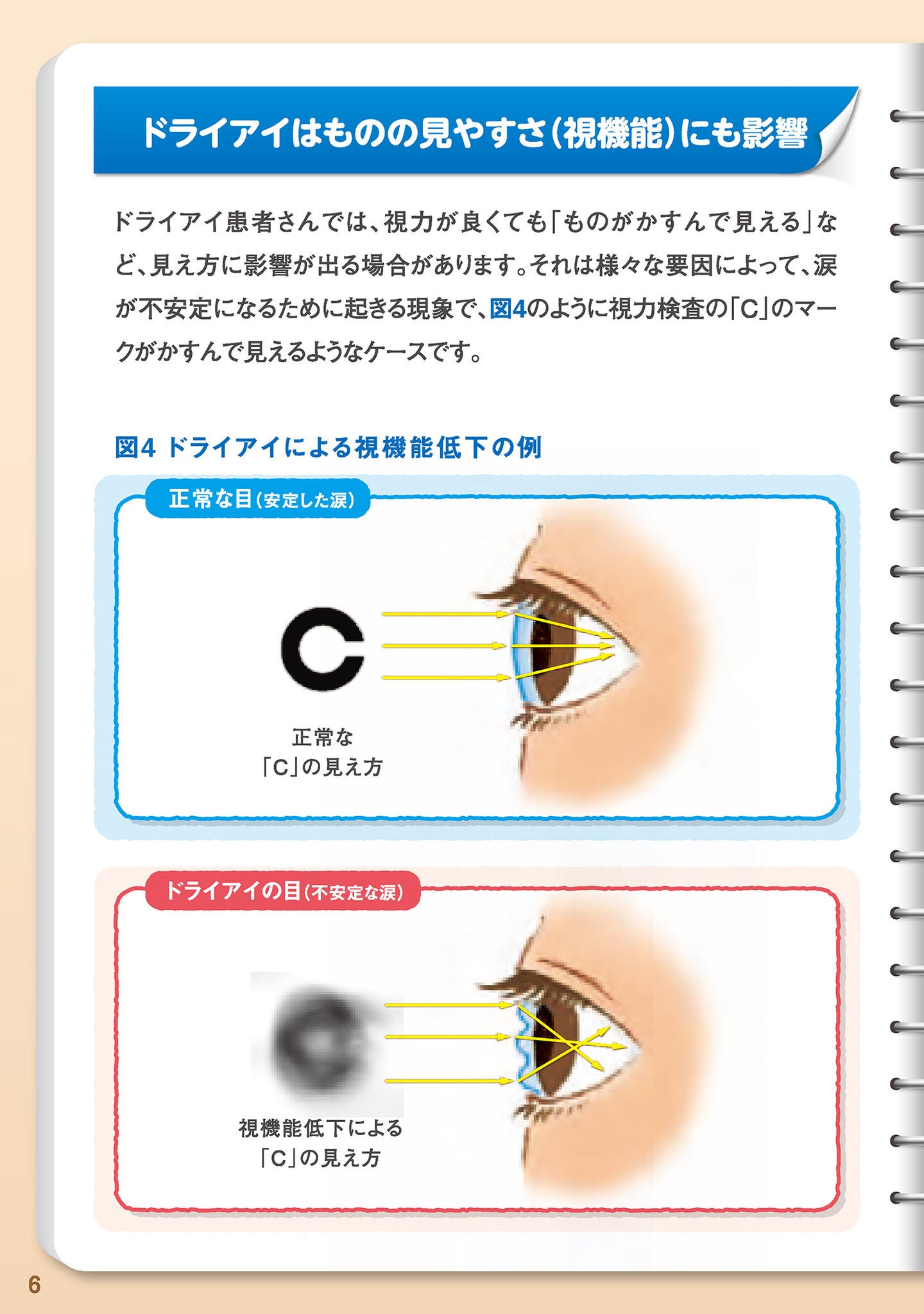 ドライアイはものの見やすさ（視機能）にも影響