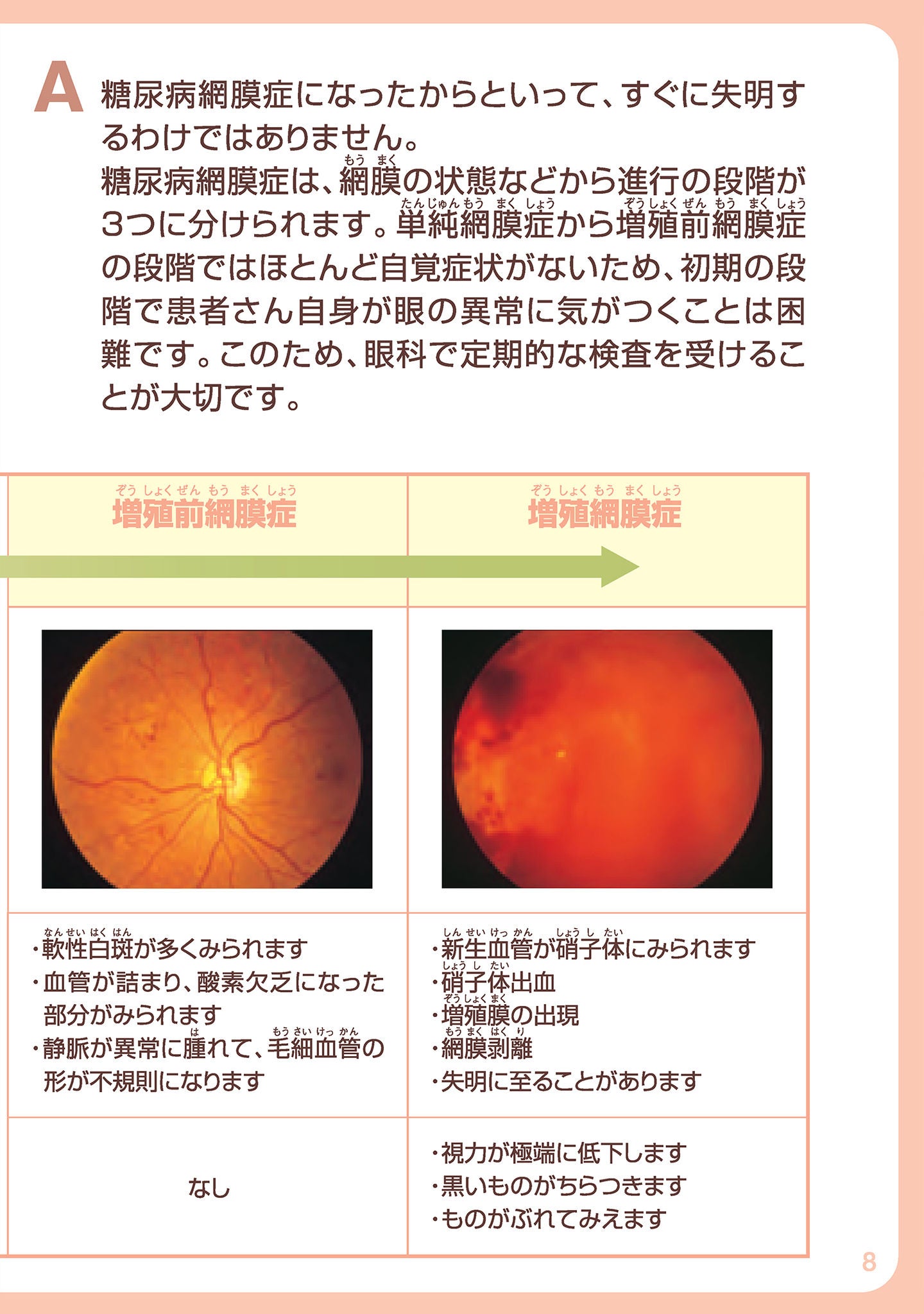 糖尿病から眼を守る | 参天製薬日本サイト